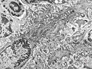 jejunal mucosa - contracted smooth muscle cells